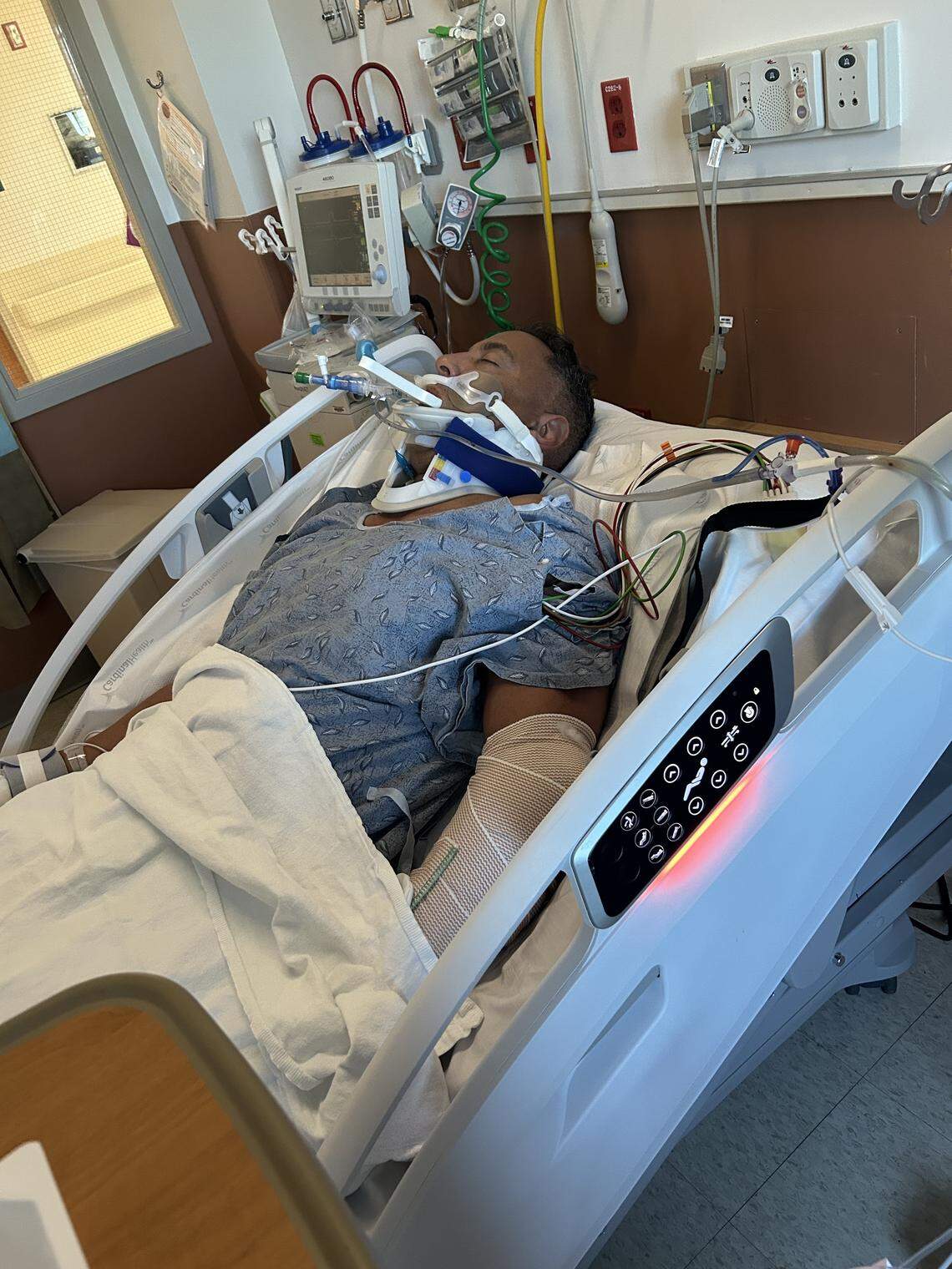 Pembroke Pines cyclist faces a long road back from crash and brain injury