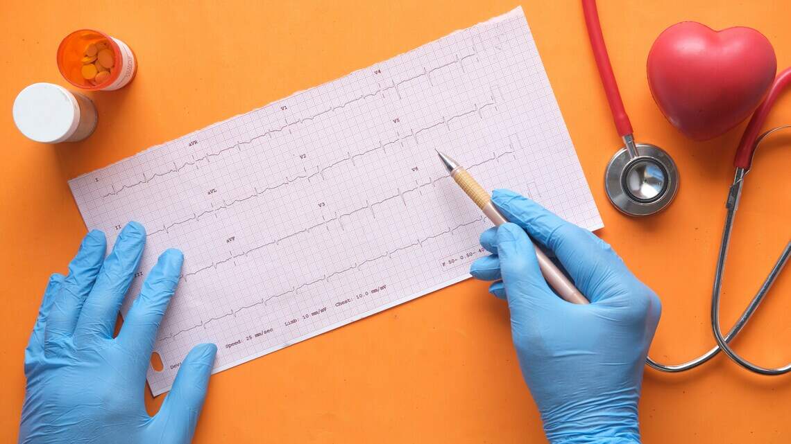 Are you at risk for vascular disease? Memorial West offering free screenings